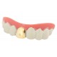 Dentier dent en or 