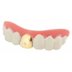 Dentier dent en or 